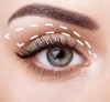 جراحی پلک یا بلفاروپلاستی چیست؟ برای چه افرادی مناسب است؟